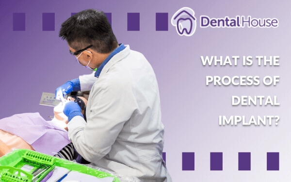 What Is The Process Of Dental Implant?