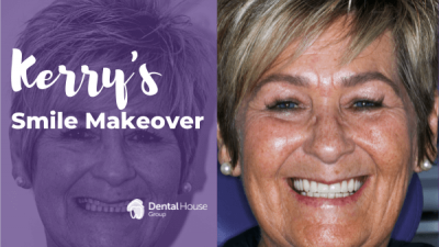Kerry’s Smile Makeover in Sunbury