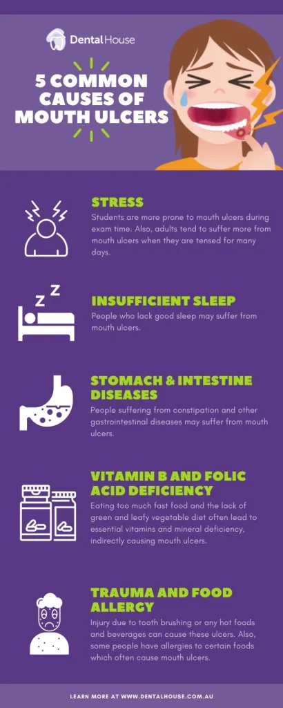 5 common causes of mouth ulcers