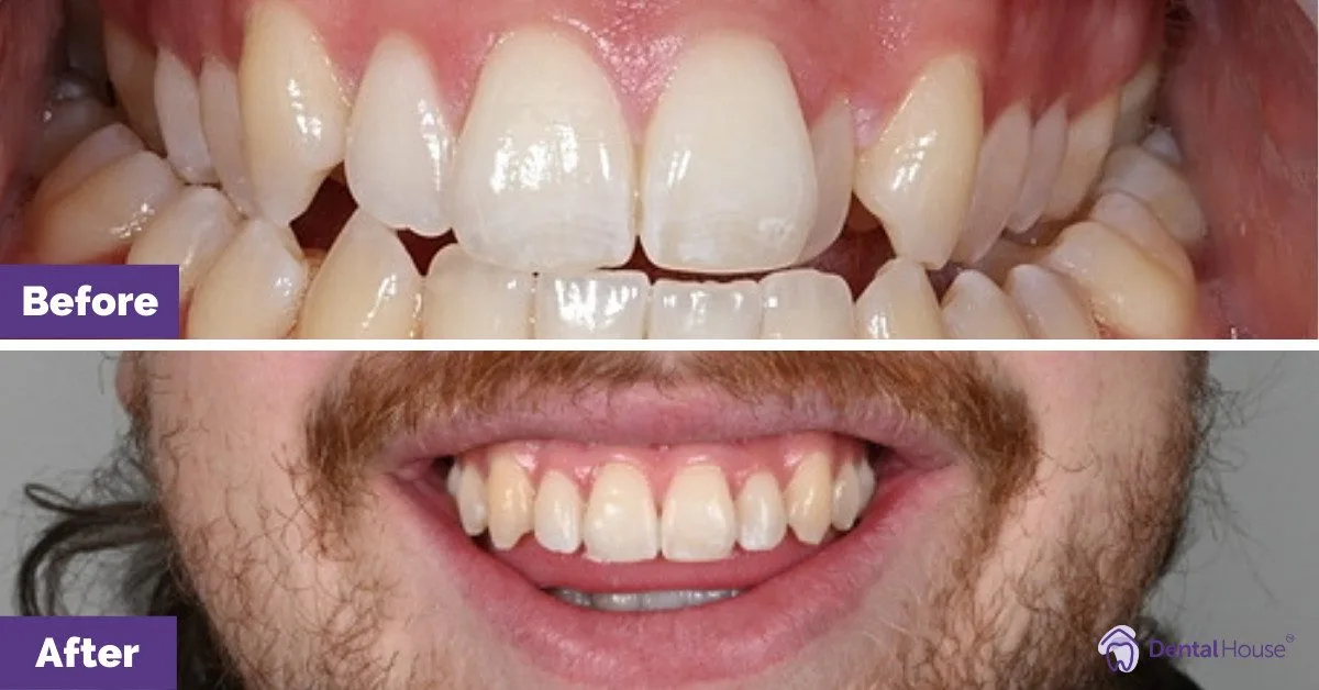Cahills Invisalign in Sunbury 4